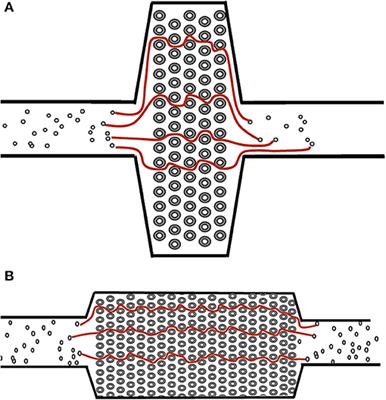 Paracorporeal Lung Devices: Thinking Outside the Box